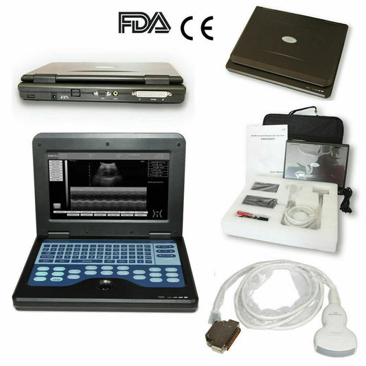 Digital Laptop Machine Ultrasound Scanner